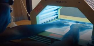 Light therapy may accelerate healing of burns: Study Light therapy may accelerate healing of burns: Study