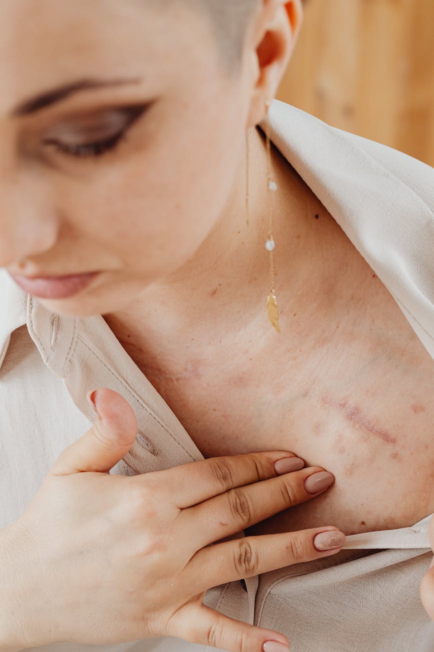 a woman with scars on her chest