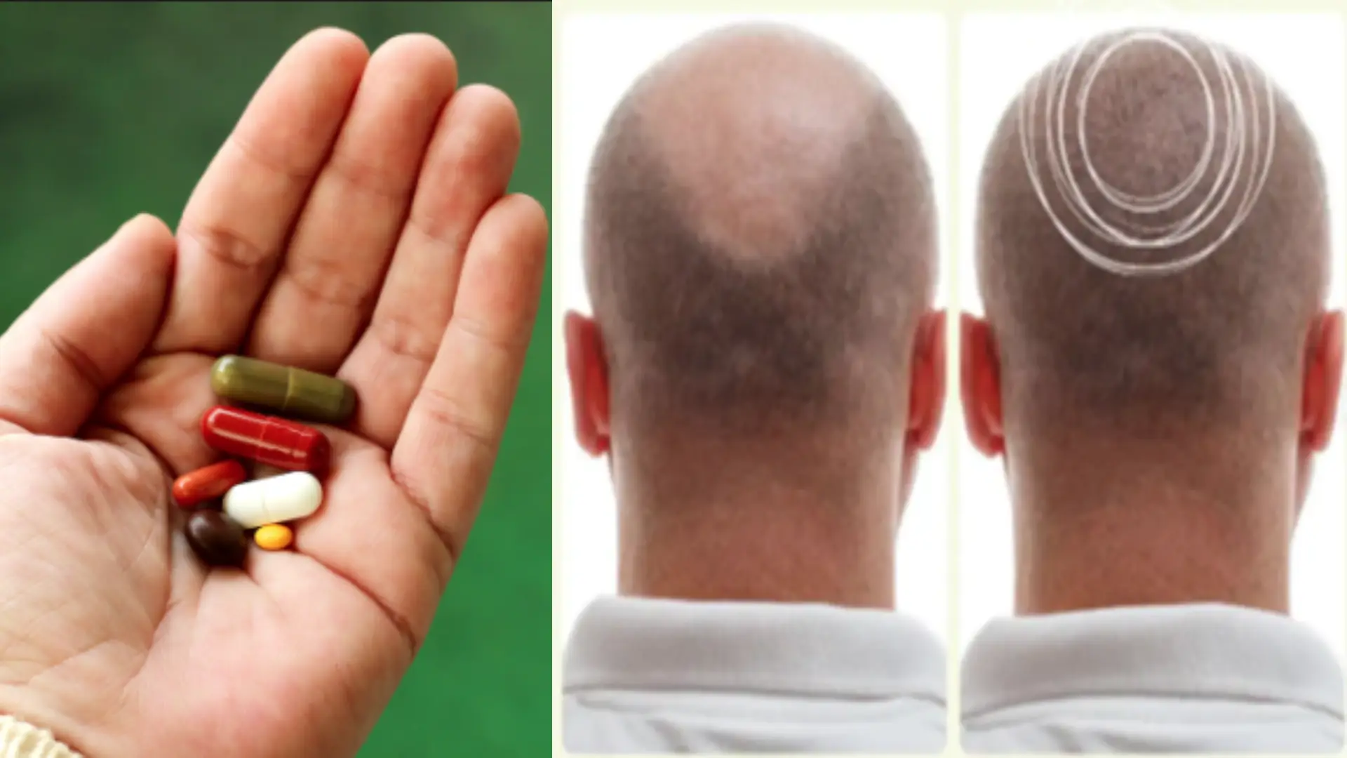 10 BEST HAIR GROWTH SUPPLEMENTS